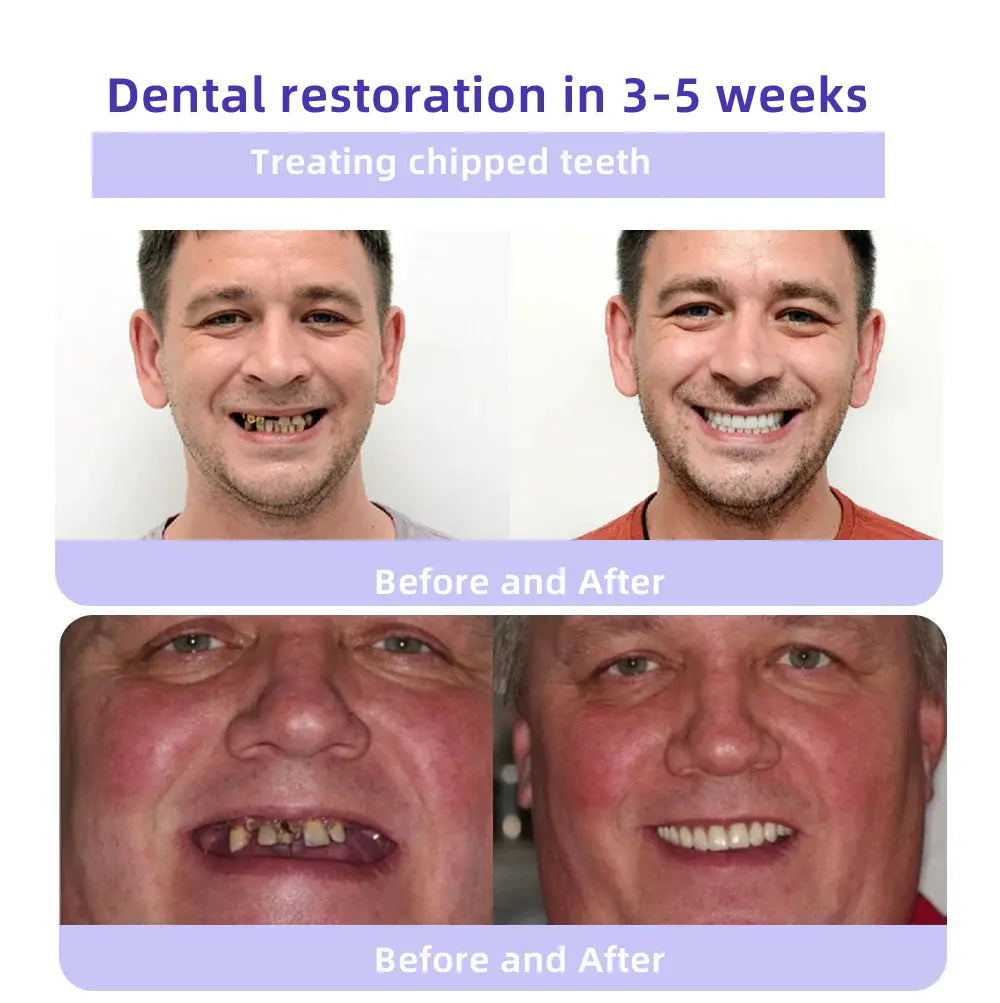 Oyikey® Proszek Mineralny do Odbudowy Zębów