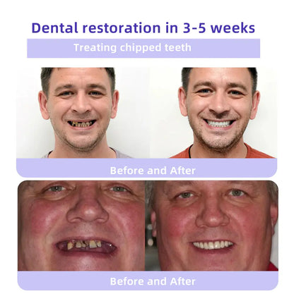 Oyikey® Proszek Mineralny do Odbudowy Zębów